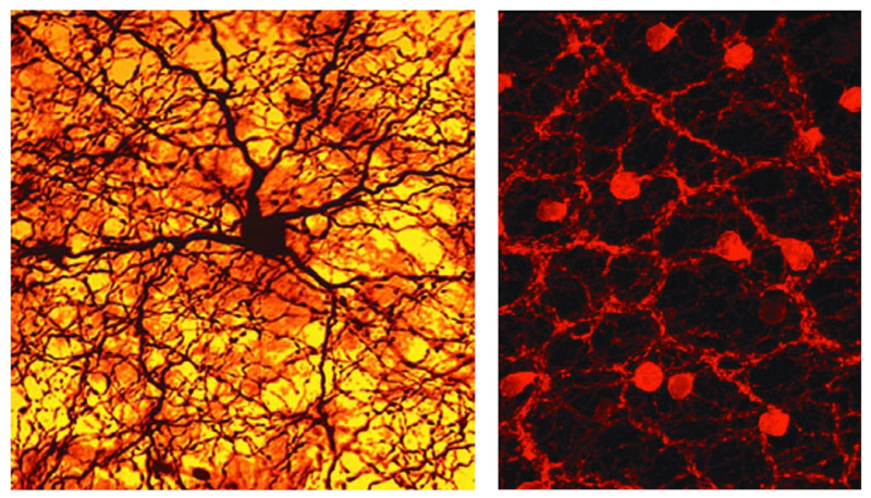 Photomicrographs highlighting two different kinds of amacrine cells show dense networks of dendrites and axons, which send information to various types of cells. One is stained for the global neuromodulator dopamine (left), and the other for the local synaptic neurotransmitter acetylcholine (right).